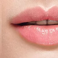 Tiêm Filler tạo hình môi